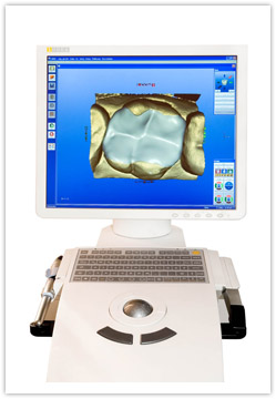 Cerec 2