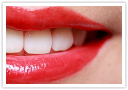 Mund mit schönen Zähnen nach Behandlung durch Zahnarzt Kratzenstein in Böblingen/Sindelfingen